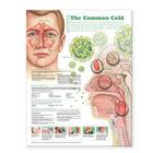 Understanding the Common Cold Anatomical Chart Cover Image