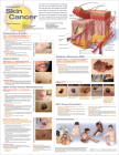 Understanding Skin Cancer Anatomical Chart Cover Image