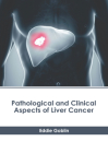 Pathological and Clinical Aspects of Liver Cancer By Eddie Goblin (Editor) Cover Image