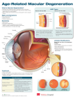 Age-Related Macular Degeneration Anatomical Chart Cover Image