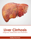 Liver Cirrhosis: Diagnosis, Medication and Treatment Cover Image