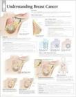 Understanding Breast Cancer Wall Chart By Various Cover Image
