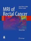 MRI of Rectal Cancer: Clinical Atlas [With CDROM] By Arnd-Oliver Schäfer, Mathias Langer Cover Image