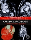 Cardiac Sarcoidosis: A Multi-Discipline Approach Cover Image
