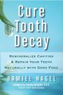 Cure Tooth Decay: Remineralize Cavities and Repair Your Teeth Naturally with Good Food By Ramiel Nagel, D. D. S. Timothy Gallagher (Foreword by) Cover Image