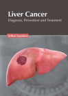 Liver Cancer: Diagnosis, Prevention and Treatment By Arthur Saunders (Editor) Cover Image