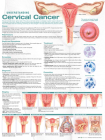 Understanding Cervical Cancer Anatomical Chart Cover Image