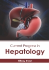 Current Progress in Hepatology By Tiffany Brown (Editor) Cover Image