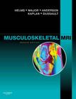 Musculoskeletal MRI By Clyde A. Helms, Nancy M. Major, Mark W. Anderson Cover Image