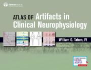 Atlas of Artifacts in Clinical Neurophysiology By William Tatum Cover Image