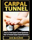 Carpal Tunnel: How To Treat Carpal Tunnel Syndrome: How To Prevent Carpal Tunnel Syndrome By Ace McCloud Cover Image
