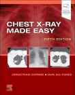 Chest X-Ray Made Easy By Jonathan Corne, Iain Au-Yong Cover Image