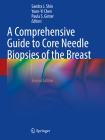 A Comprehensive Guide to Core Needle Biopsies of the Breast Cover Image