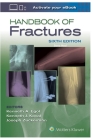 Handbook of Fractures By Steve Neal Cover Image