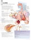 Copd Chart: Laminated Wall Chart: Laminated Wall Chart Cover Image