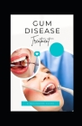 Gum Disease Cover Image
