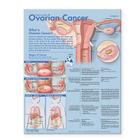 Understanding Ovarian Cancer Anatomical Chart Cover Image