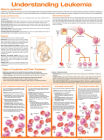 Understanding Leukemia Anatomical Chart Cover Image