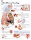 Effects of Smoking Chart: Wall Chart By Scientific Publishing (Other) Cover Image