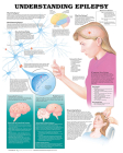 Understanding Epilepsy Anatomical Chart Cover Image
