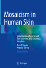 Mosaicism in Human Skin: Understanding Nevi, Nevoid Skin Disorders, and Cutaneous Neoplasia By Rudolf Happle, Antonio Torrelo Cover Image