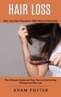 Hair Loss: How You Can Prevent It With Natural Remedies (The Ultimate Guide and Easy Tips on Overcoming Postpartum Hair Loss) By Adam Foster Cover Image