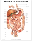 Diseases of the Digestive System Anatomical Chart By Anatomical Chart Company (Prepared for publication by) Cover Image