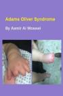 Adams Oliver syndrome: Clinical genetics By Aamir Jalal Al Mosawi Cover Image