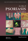 An Atlas of Psoriasis, Second Edition (Encyclopedia of Visual Medicine #77) Cover Image