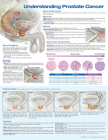 Understanding Prostate Cancer Anatomical Chart Cover Image