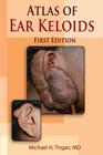 Atlas of Ear Keloids By Michael H. Tirgan Cover Image