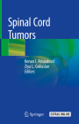 Spinal Cord Tumors By Kenan I. Arnautovic (Editor), Ziya L. Gokaslan (Editor) Cover Image