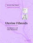 Uterine Fibroids: Embolization and Other Treatments Cover Image