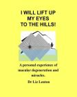 I will lift up my eyes to the hills!: A personal experience of macular degeneration and miracles Cover Image