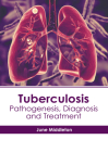 Tuberculosis: Pathogenesis, Diagnosis and Treatment By June Middleton (Editor) Cover Image