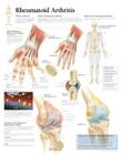 Rheumatoid Arthritis: Laminated Wall Chart Cover Image