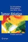 Tumor Ablation: Principles and Practice Cover Image
