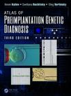 Atlas of Preimplantation Genetic Diagnosis (Encyclopedia of Visual Medicine) By Anver Kuliev, Svetlana Rechitsky, Oleg Verlinsky Cover Image