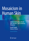 Mosaicism in Human Skin: Understanding Nevi, Nevoid Skin Disorders, and Cutaneous Neoplasia Cover Image