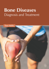 Bone Diseases: Diagnosis and Treatment By Dan Heller (Editor) Cover Image