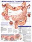Understanding Colorectal  Cancer Anatomical Chart Cover Image