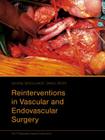 Reinterventions in Vascular and Endovascular Surgery Cover Image