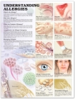 Understanding Allergies Anatomical Chart Cover Image