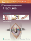Master Techniques in Orthopaedic Surgery: Fractures By Michael J. Gardner, MD Cover Image