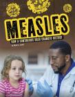 Measles: How a Contagious Rash Changed History Cover Image