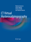CT Virtual Hysterosalpingography Cover Image