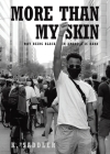 More Than My Skin: Why Being Black In America Is Hard Cover Image