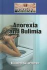 Anorexia and Bulimia (Diseases & Disorders) By Elizabeth Silverthorne Cover Image