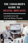 The Consumer's Guide To Dental Implants: Learn Insider Secrets and Avoid Costly Mistakes Of Implants: The Pros And Cons Of Each Implants Option By Amos Moats Cover Image