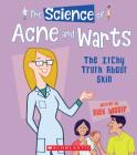 The Science of Acne and Warts: The Itchy Truth About Skin (The Science of the Body) (Library Edition) (The Science of...) By Alex Woolf Cover Image